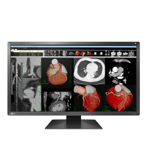 EIZO RadiForce MX317