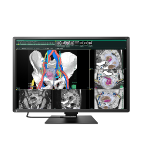 EIZO RadiForce RX670