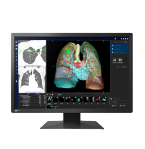 EIZO RadiForce MX243