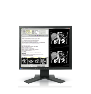 EIZO RadiForce MX194
