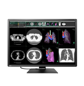 EIZO RadiForce RX1270
